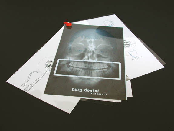 burgdental